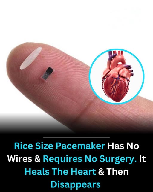 World’s Smallest Pacemaker Could Revolutionize Heart Treatment