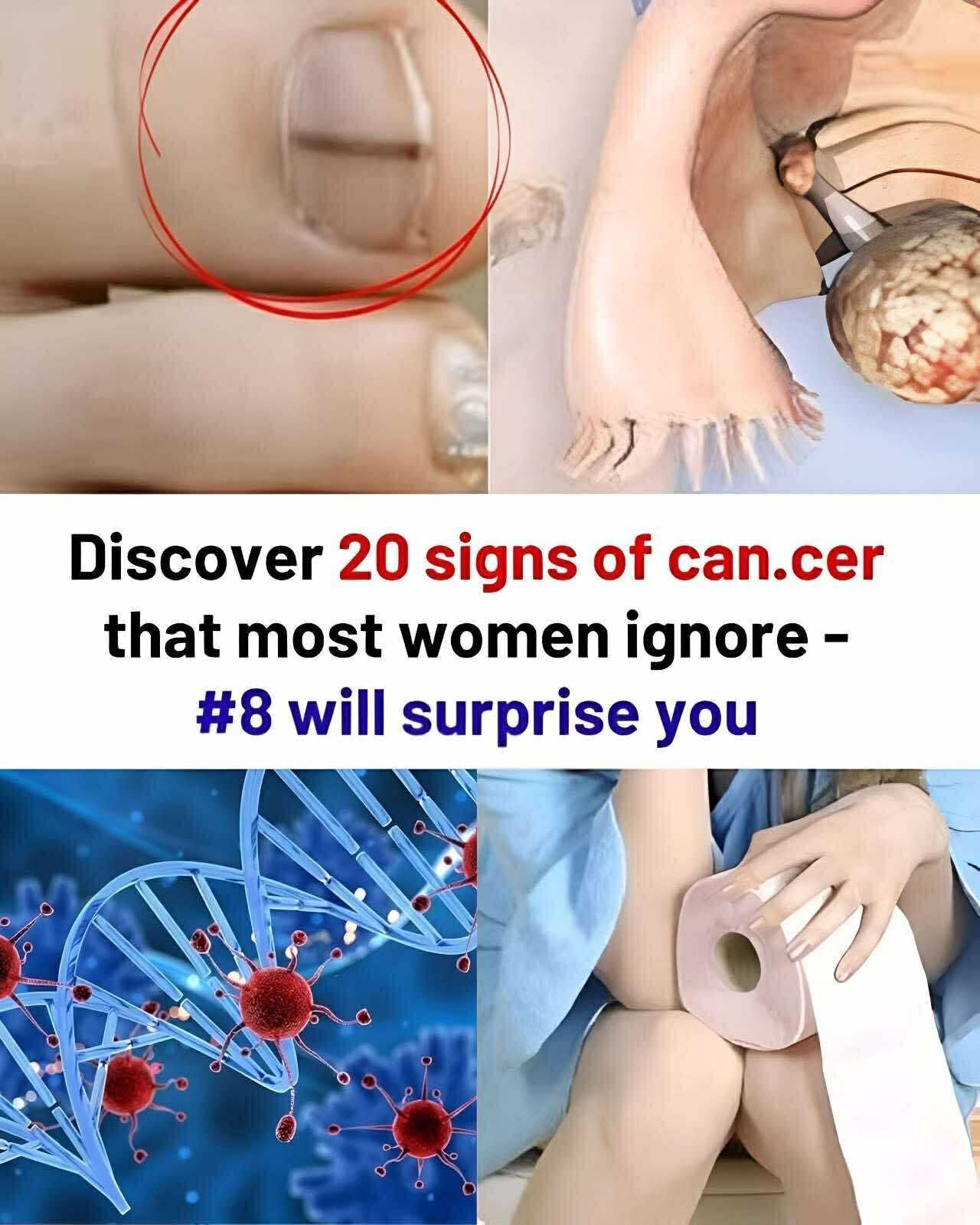 20 Subtle Cạncer Symptoms That Are Easy to Miss