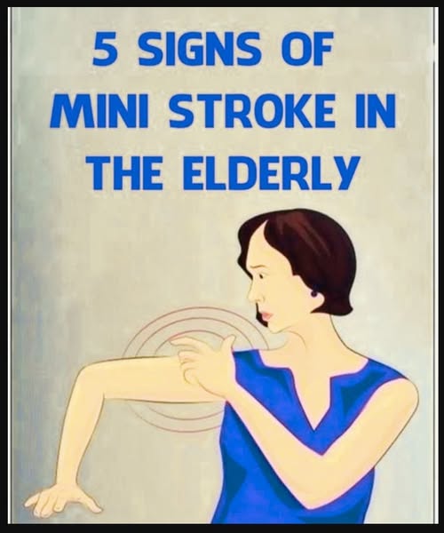 What You Need to Know About Mini Strokes in Older Adults