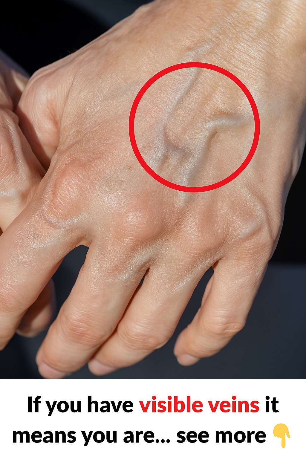 Visible Veins Appearing Suddenly? When It’s Normal and When to See a Doctor