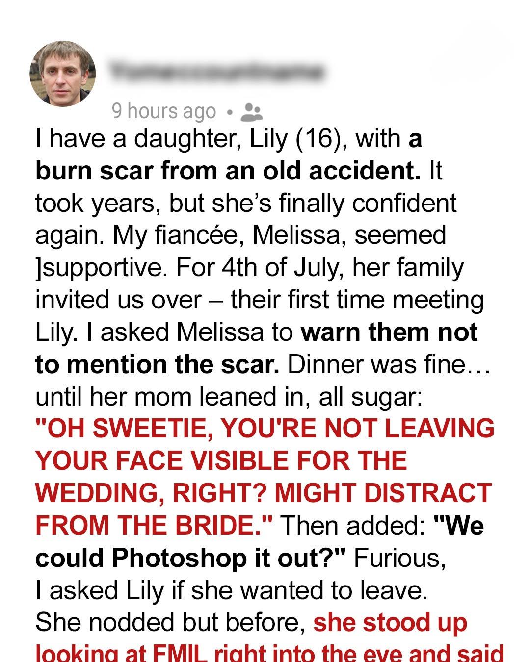 My Fiancée’s Mom Insulted My Daughter’s Scar—Her Comeback Silenced the Whole Table