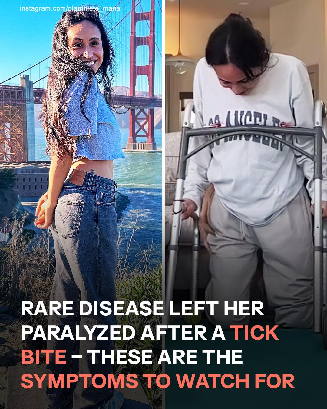 She Was Young, Healthy, and Active — Then a Tick Bite Changed Everything