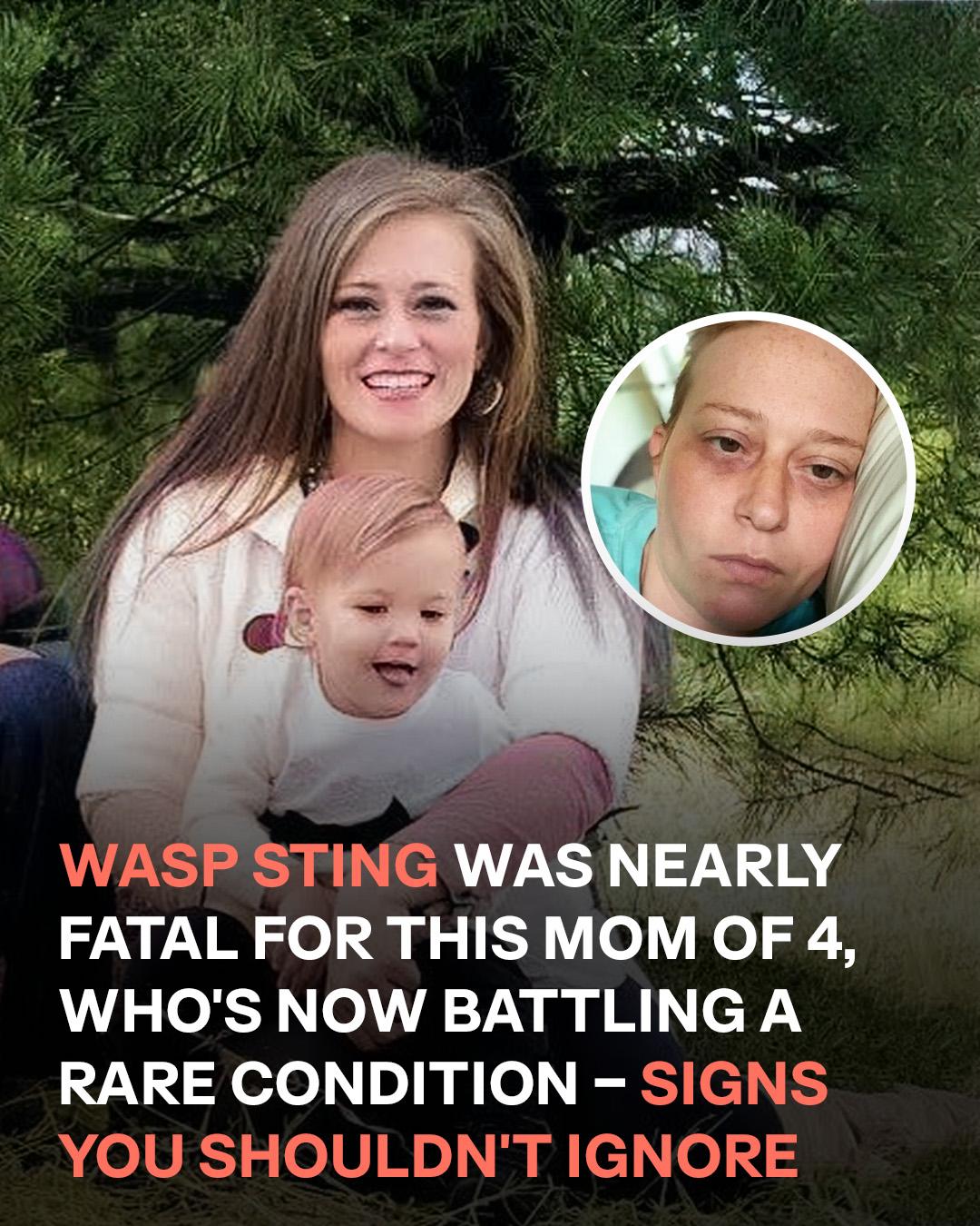 Wasp Sting Uncovered Rare Illness That Trapped Mom of 4 Inside Her Home