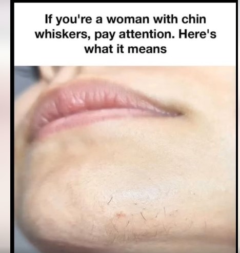 Why Chin Hair Grows: What Science Says