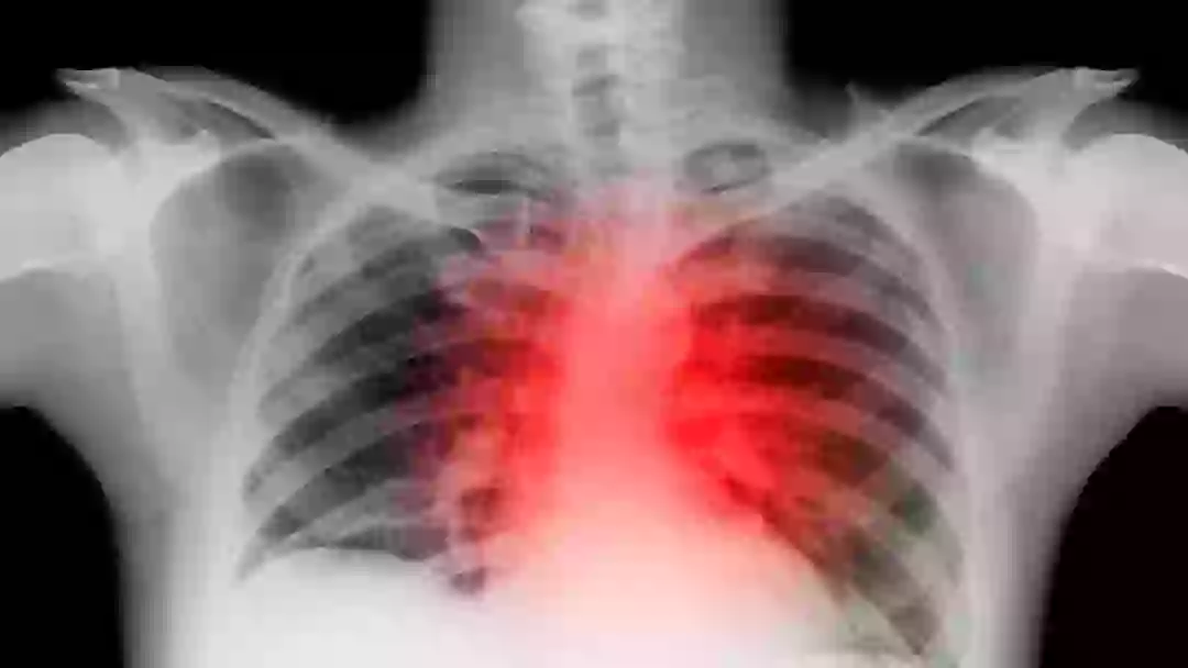 Doctors Warn About Hidden ‘Silent Killer’ Disease That Shows No Early Symptoms