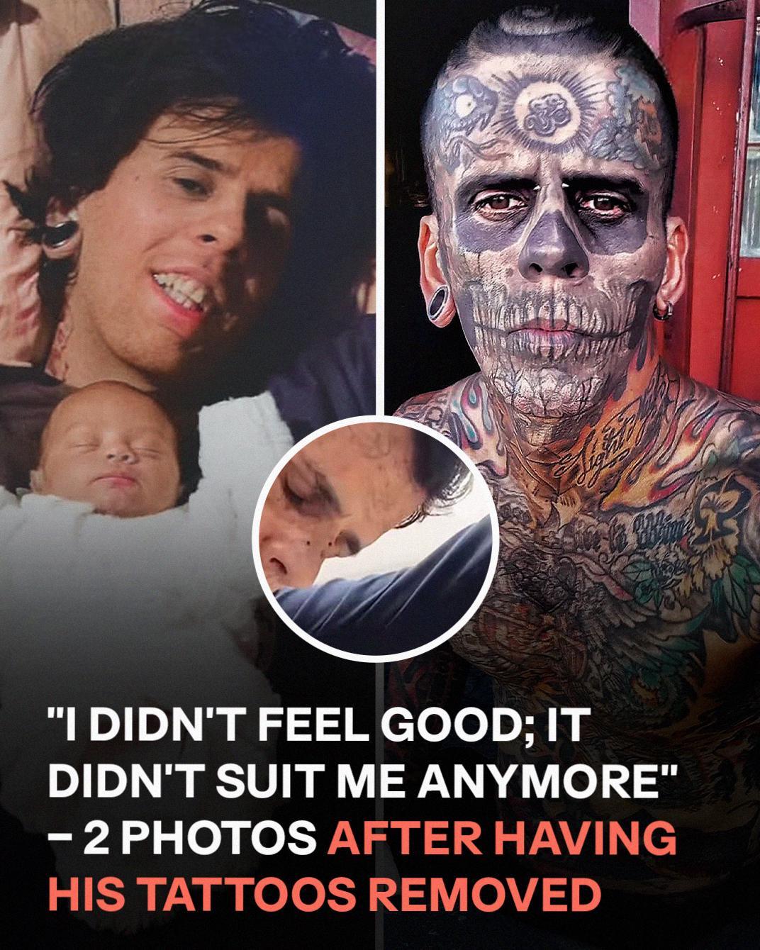 A Man Once Known as Brazil’s Most Tattooed Reveals His Stunning Transformation After Erasing His Past
