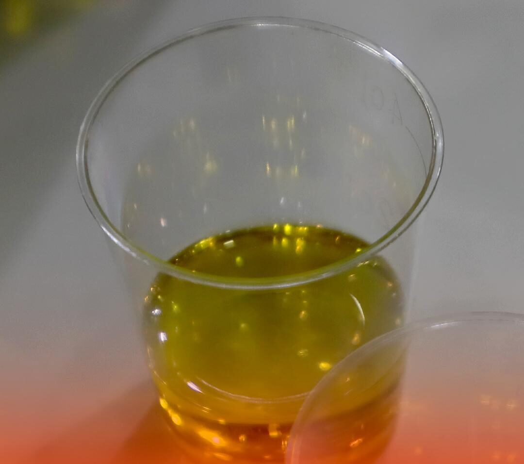 Woman Took a Shot of Olive Oil Every Day for a Week — What Happened to Her Body Might Surprise You