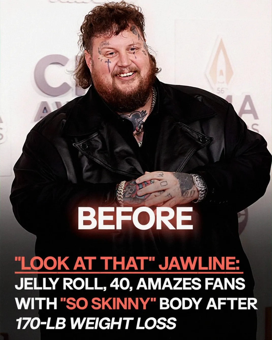 Jelly Roll, 40, Impresses Fans With His Slim Look After Nearly 200-Pound Weight Loss